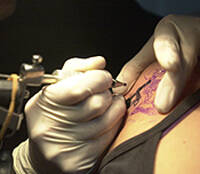 Cada vez más personas quieren eliminar sus tatuajes