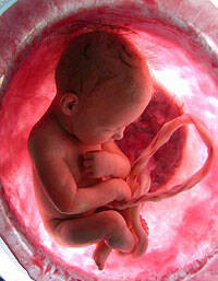 El aborto produce un grave riesgo para la salud psíquica