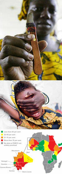 Unas 70 millones de mujeres en 27 países han sufrido mutilación genital