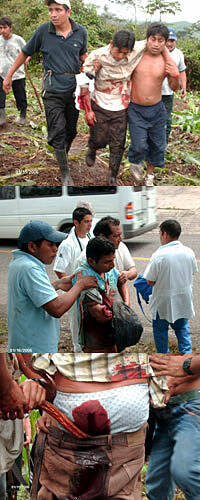 Ataque brutal -con machetes- a cristianos en Chiapas, con un muerto y doce heridos graves