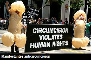 San Francisco va camino de votar si prohibir la circuncisión a menores