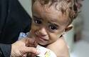 Yemen, la peor crisis humanitaria del mundo