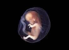 ¿Es el embrión un ser humano?
