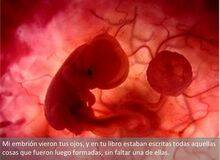 “La Biblia no dice ‘no abortarás”