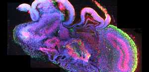 Crean ‘cerebroides’ humanos con células madre de embriones