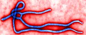 Siete datos claves sobre el virus ébola