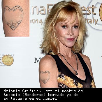 Efecto Melanie (Griffith): borrar tatuajes indeseados
